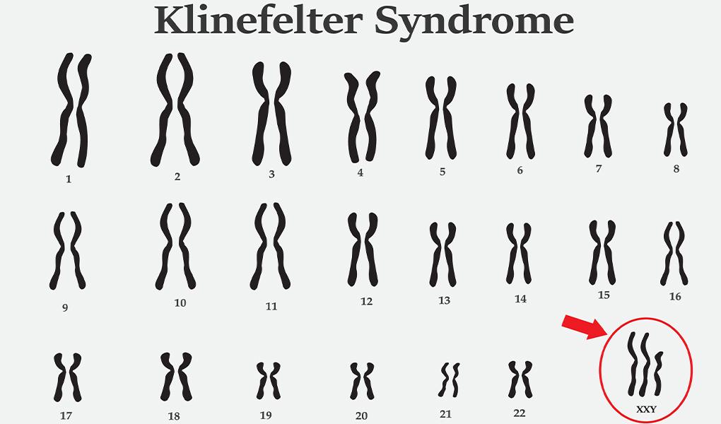 NCERT Solution Class 12 Biology Chapter 5 Principles of Inheritance and Variation – Class 12 Biology Chapter 5