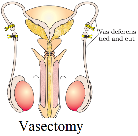 NCERT Solution Class 12 Biology Chapter 4 Reproductive Health – Class 12 Biology Chapter 4