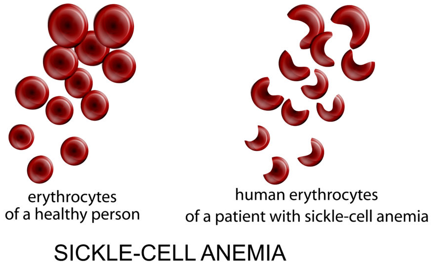 NCERT Solution Class 12 Biology Chapter 5 Principles of Inheritance and Variation – Class 12 Biology Chapter 5